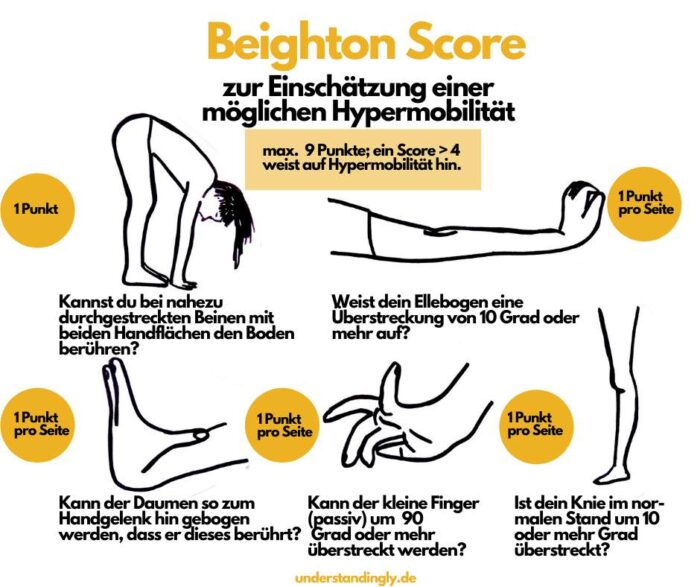 Bebilderte Grafik des Beighton Score 